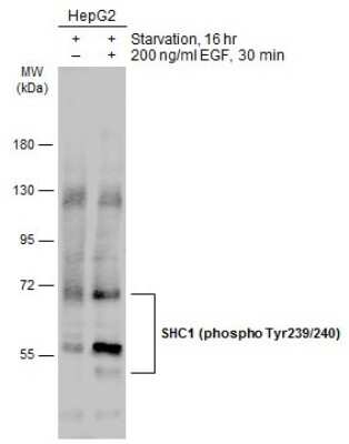 Western Blot: SHC1 [p Tyr239, p Tyr240] Antibody [NBP3-13327]